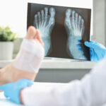 Foot and Ankle Injury Trauma Treatment