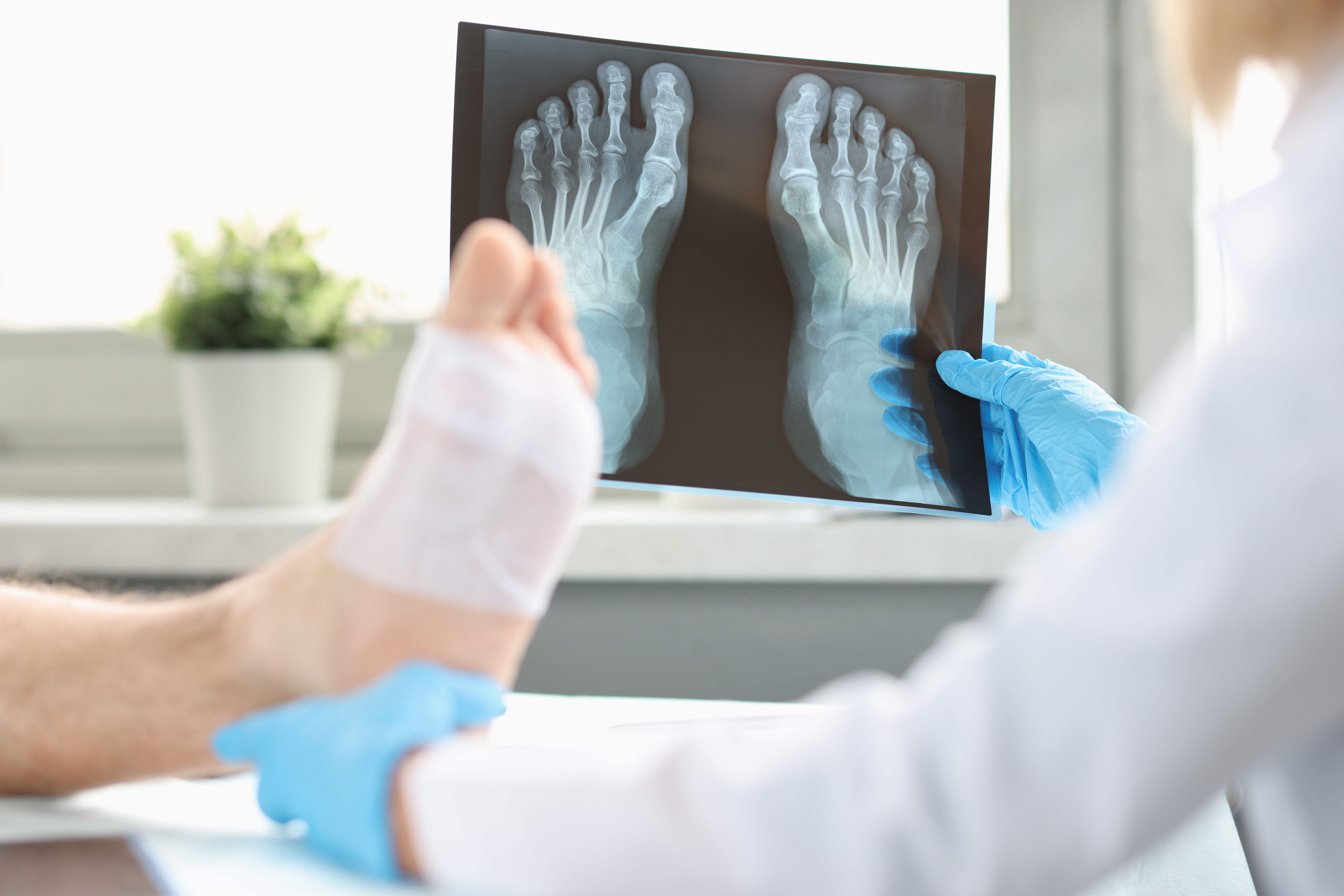 Foot and Ankle Injury Trauma Treatment