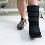 Ankle Sprain and Instability