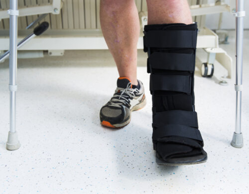 Ankle Sprain and Instability